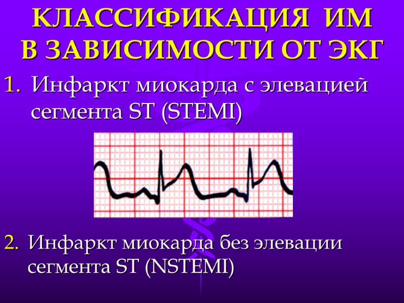 КЛАССИФИКАЦИЯ  ИМ      В ЗАВИСИМОСТИ ОТ ЭКГ Инфаркт миокарда